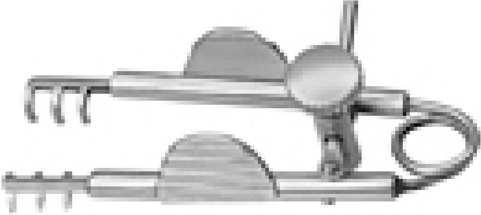 Agricola Lacrimal Sac Retractor
